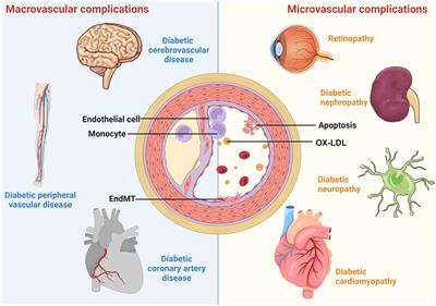 Endothelial dysfunction in vascular complications of diabetes: a comprehensive review of mechanisms and implications